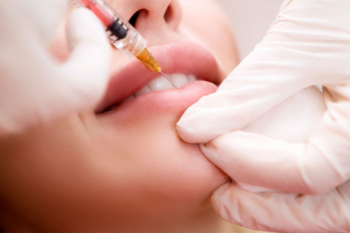 Woman receiving dermal filler with Morpheus Medical Aesthetics in Marin and Santa Rosa.